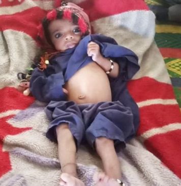 نوشکی و سنجاوی ،مضر صحت اشیاء کھانے سے 11 افراد ہسپتال داخل