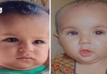 اوستہ محمد: خسرے کی وباء سے 2 بچے ہلاک