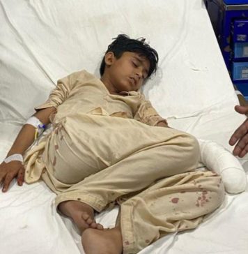 گوادر: سرکاری حمایت یافتہ گروہ کے فائرنگ سے کمسن لڑکا زخمی
