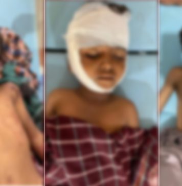 پنجگور: بچوں کی ہلاکت کا واقعہ پاکستانی فورسز کے کواڈ کاپٹر میں نصب بارودی مواد پھٹنے سے پیش آیا۔مقامی ذرائع